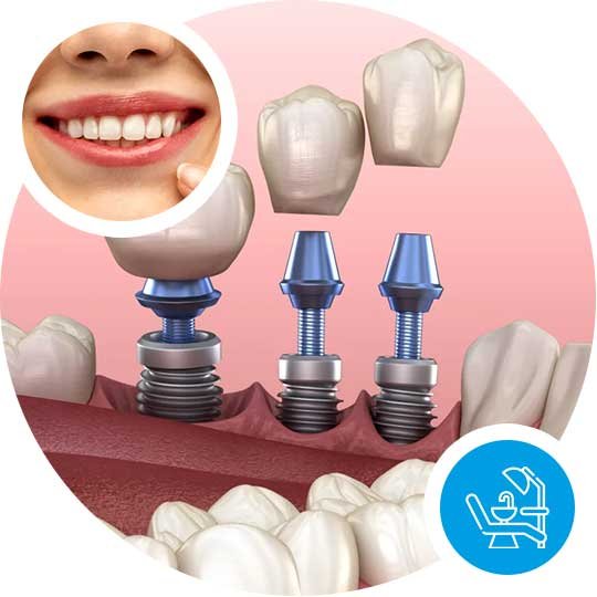 TMJ disorder Treatment in Hazaribagh