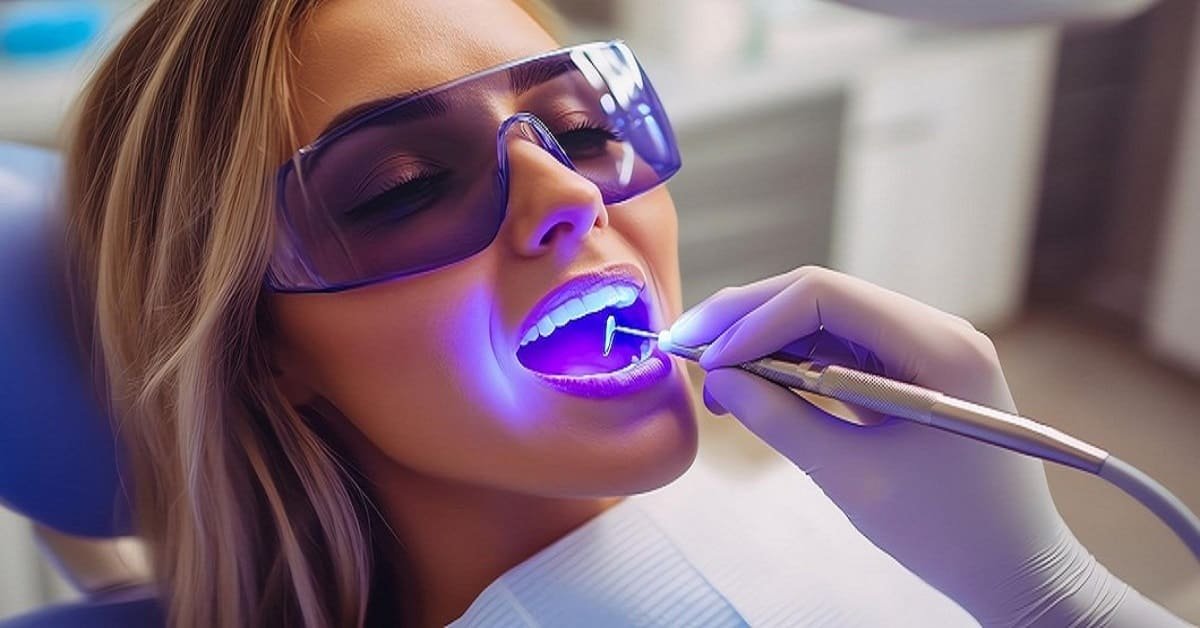 best Teeth Whitening in Hazaribagh